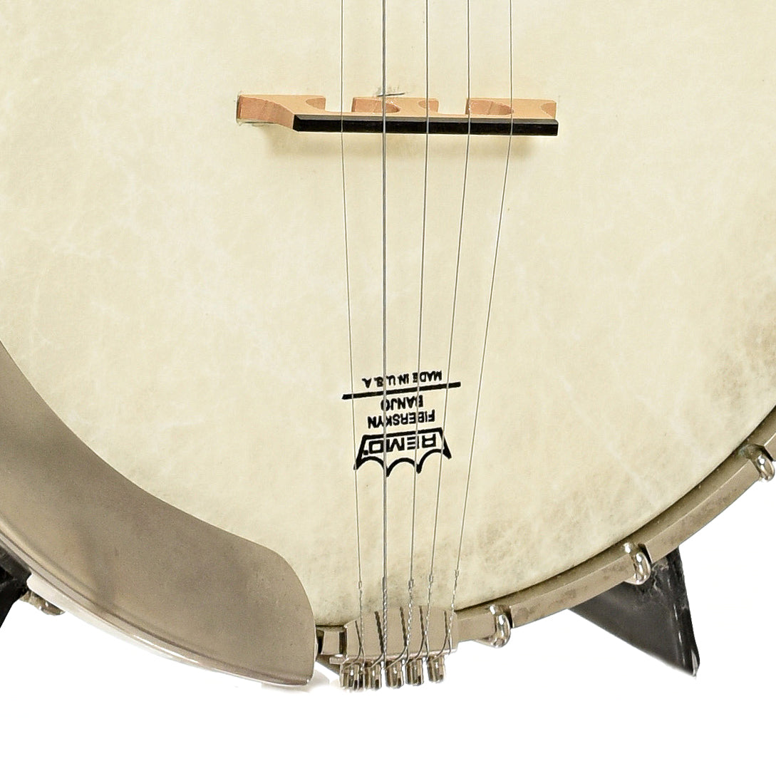 Bridge of Wildwood Artist Open Back Banjo
